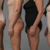 Shapewear nach Geburt